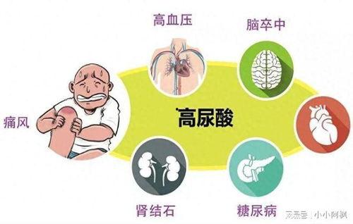痛风可以吃凉瓜吗,凉瓜的适宜食用指南